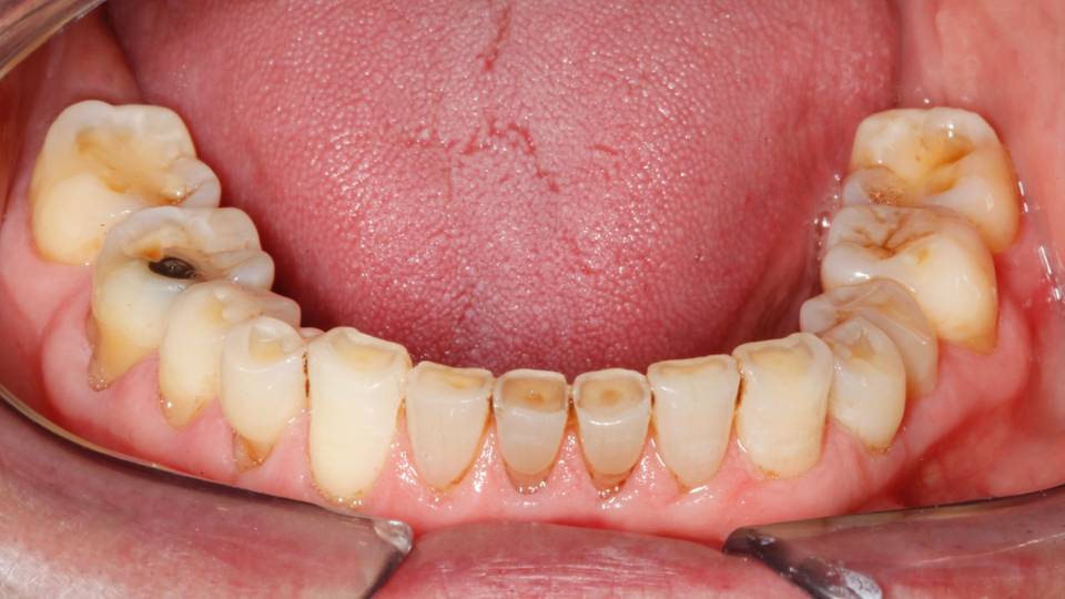 O QUE É DISFUNÇÃO NA ATM – Vintage Odontologia